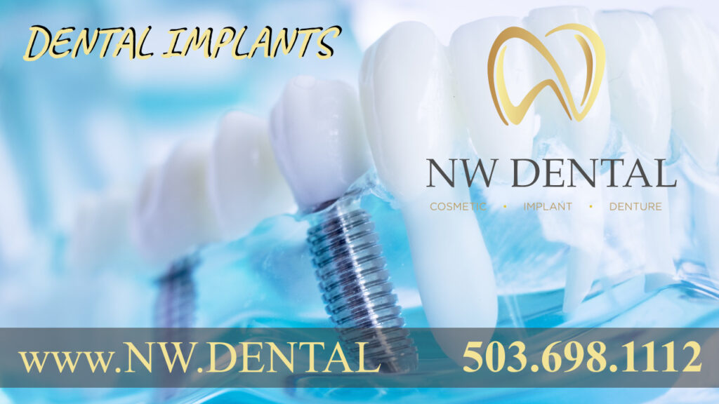NW Dental in Clackamas Oregon dentists cosmetic and emergency dentist dental implants implant dentistry